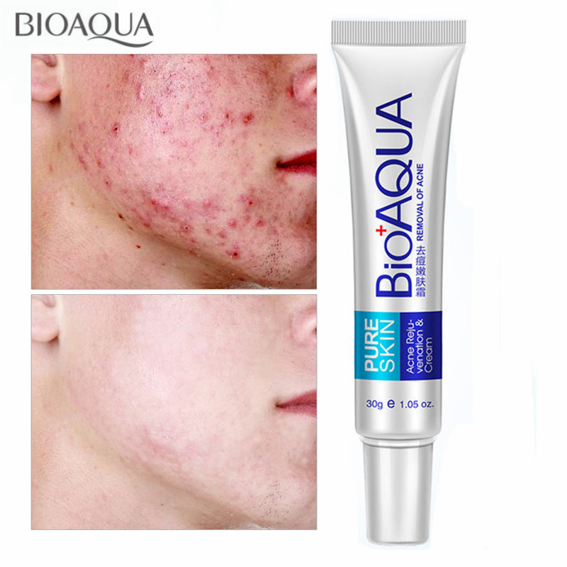 Crema anti-acné BIOAQUA